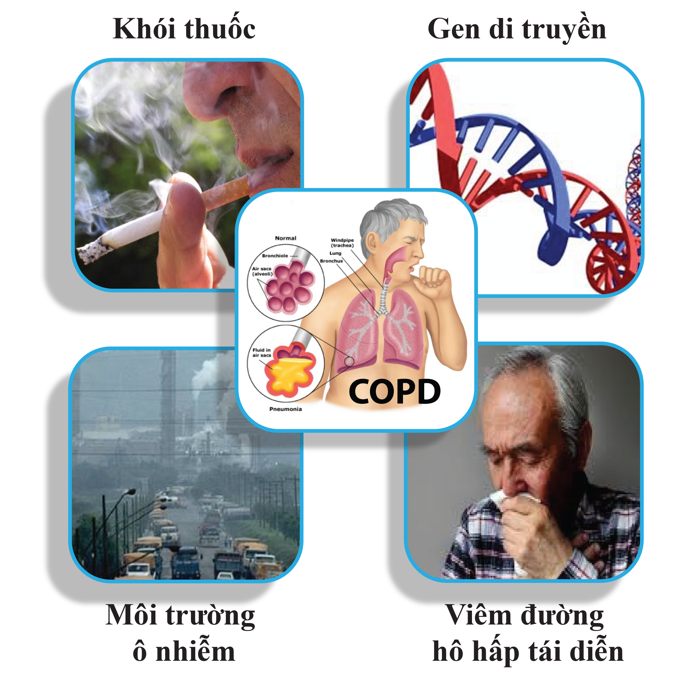 nguyên nhân gây copd